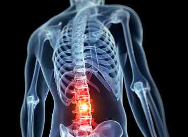 Back pain is very common