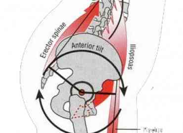 Lower Crossed Postural Self Assessment