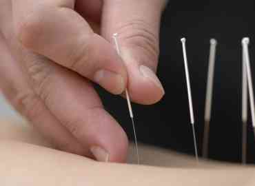 How Acupuncture can help you