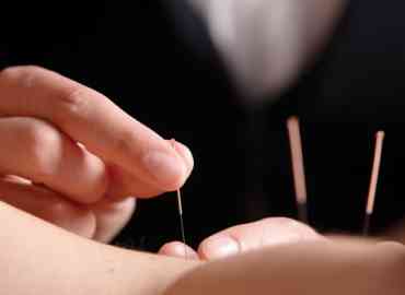 Acupuncture can relieve a number of conditions