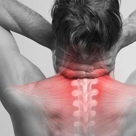 Herniated cervical discs