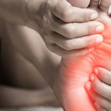 Improper Foot Mechanics: Leading to stress on the plantar fascia